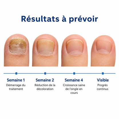 Patchs antifongiques pour ongles LERONIA™