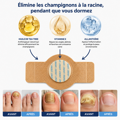 Patchs antifongiques pour ongles LERONIA™